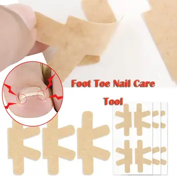 Наклейка для педикюра для ухода за пальцами ног, наклейки для лечения вросших ногтей, наклейки для коррекции ногтей, Пластырь для ухода за ногтями, Инструменты для педикюра